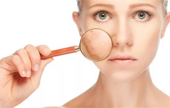 皮膚屏障受損？這些表現要警惕！